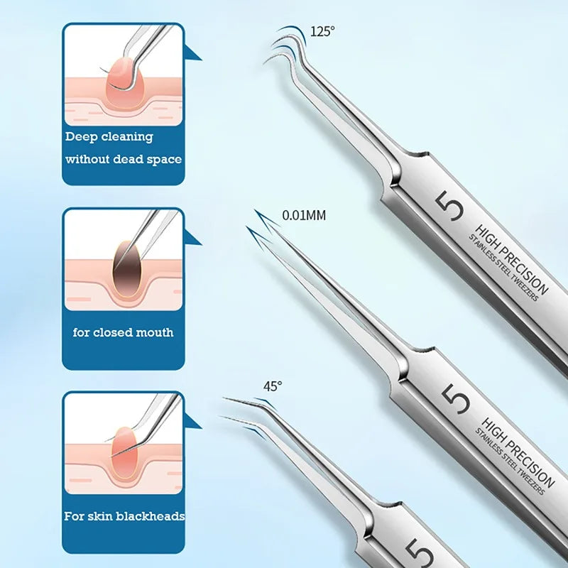 German Precision Blackhead and Acne Extractor Set for Clear Skin