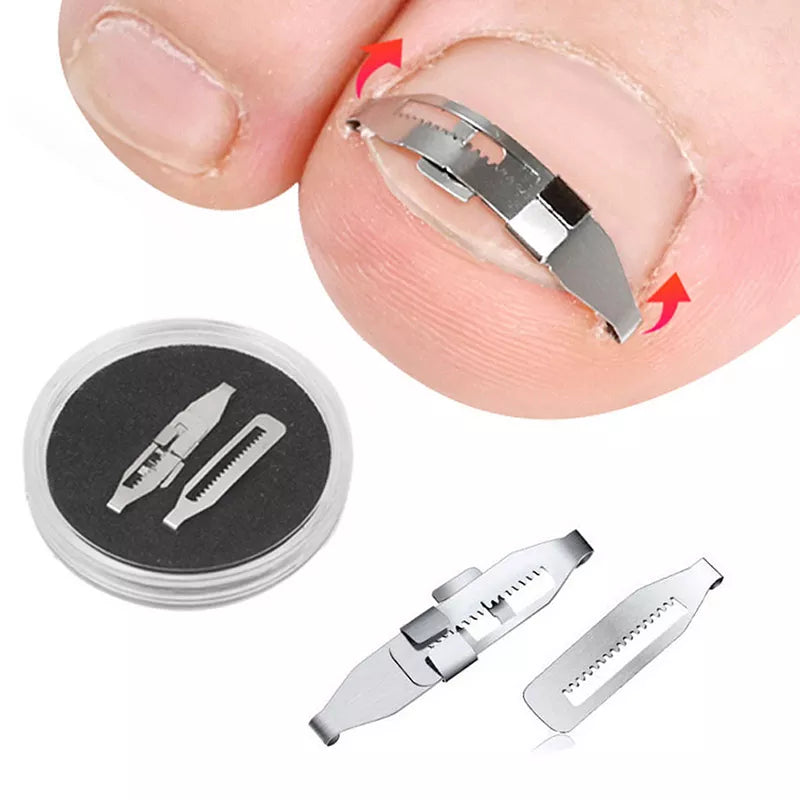 Ingrown Toenail Corrector Tools Pedicure Recover Embed Toe Nail Treatment Professional Ingrown Toenail Correction Foot Care Tool  beautylum.com   