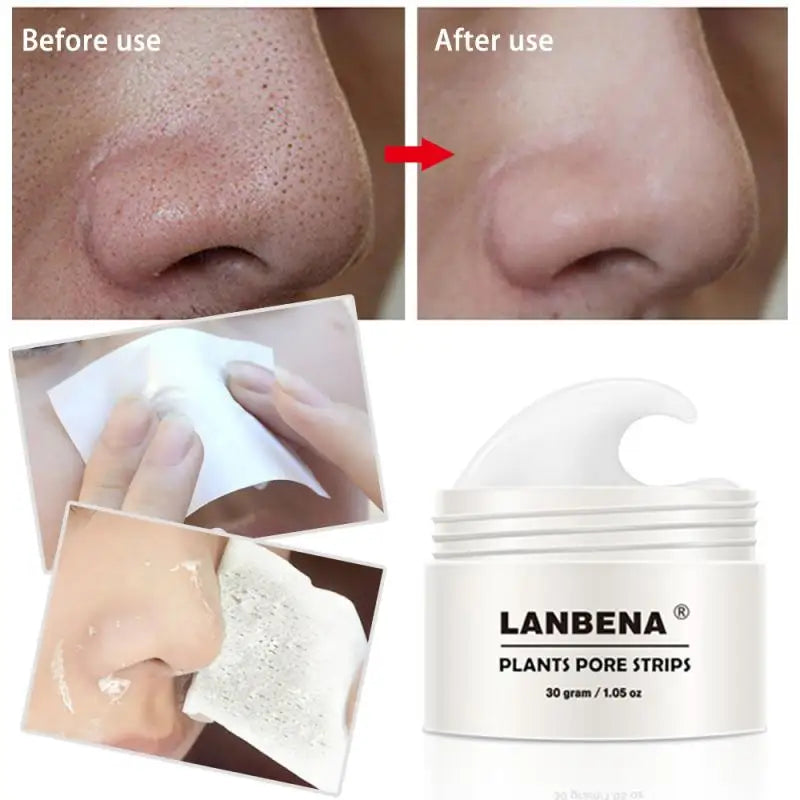 LANBENA Blackhead Remover Kit: Deep Cleansing Pore Strips & Acne Mud Mask
