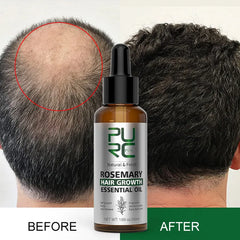 Rosemary Oil Hair Growth Elixir - Transform Your Haircare Journey
