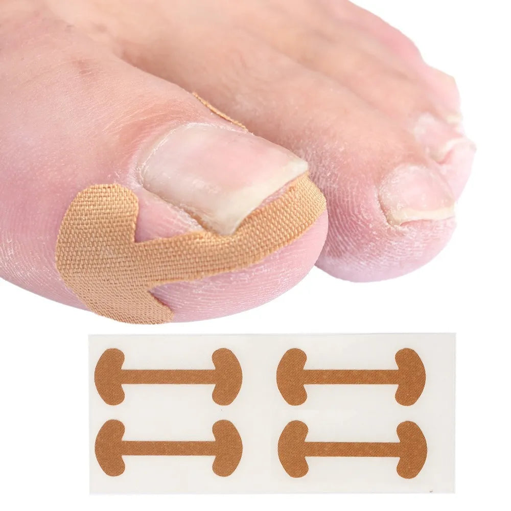 20pcs Professional Ingrown Toenail Foot Corrector Stickers Elasticity Toe Nail Care Pedicure Tools Health Care Protects Toe Nail  beautylum.com   