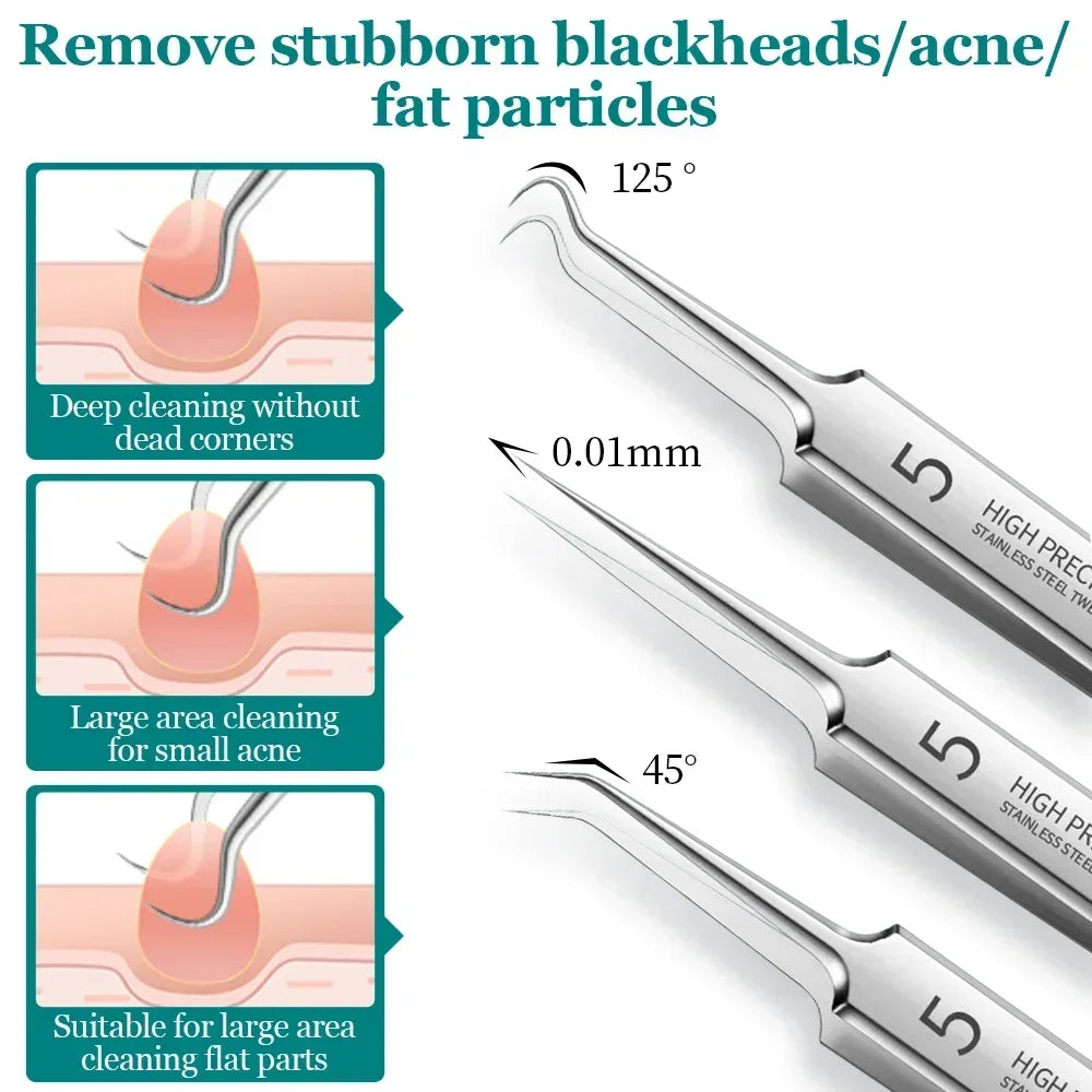 Deep Skin Cleaning Tool Set: Blackhead Acne Pimple Remover Tweezers