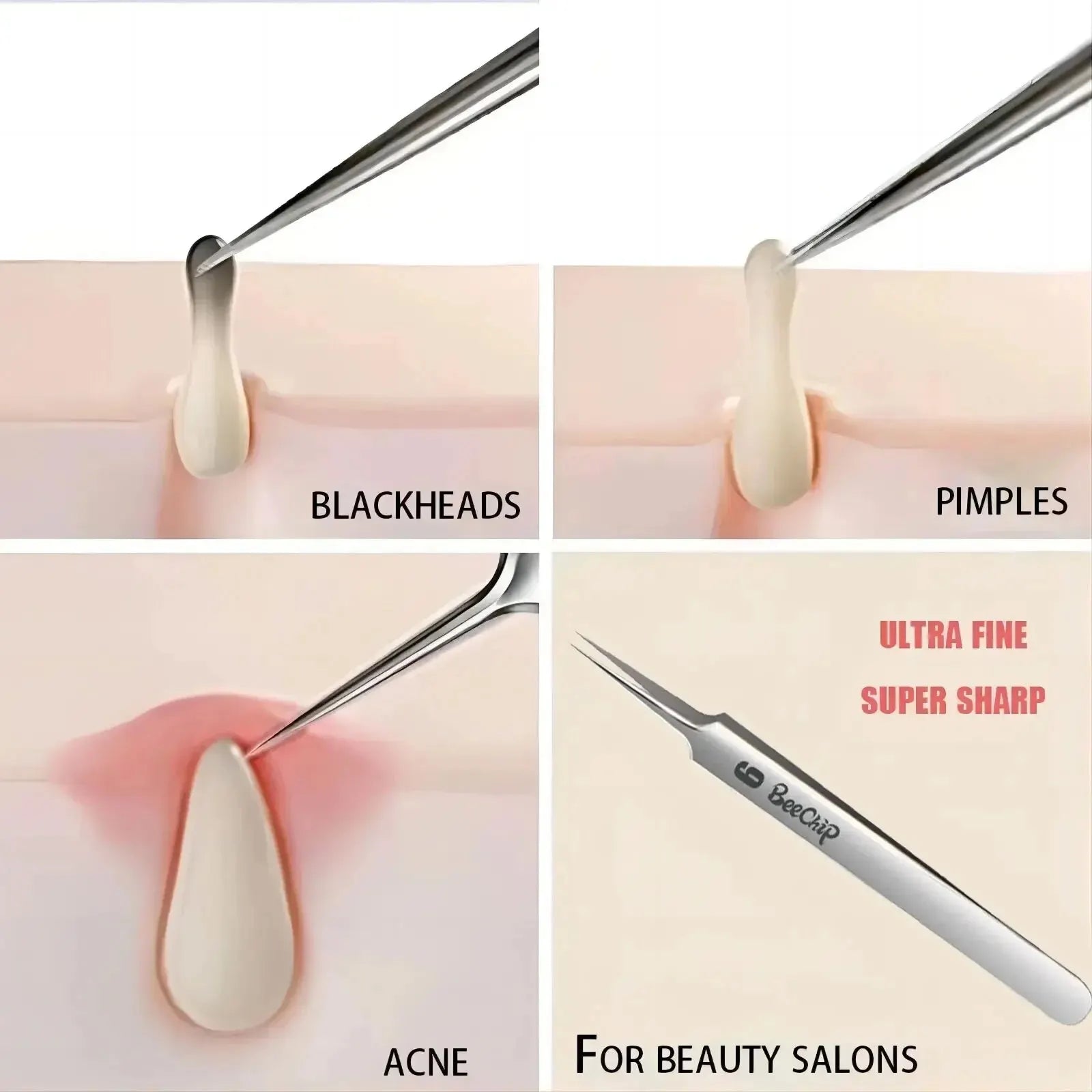 3PCS Facial Pore Cleaning Care Tools Ultra Fine Needle Tweezers Blackheads Acne Wart Skin Tag Removal Point Noir Black Head Clip  beautylum.com   