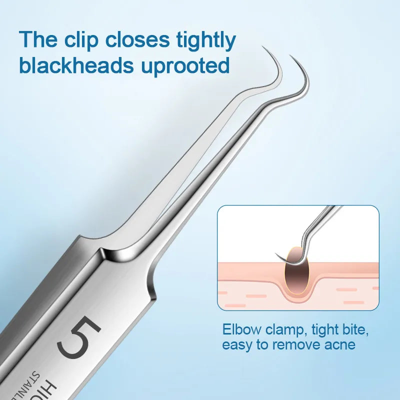 Blackhead Removal Kit: Stainless Steel Tools for Clear Skin & Pimple Care