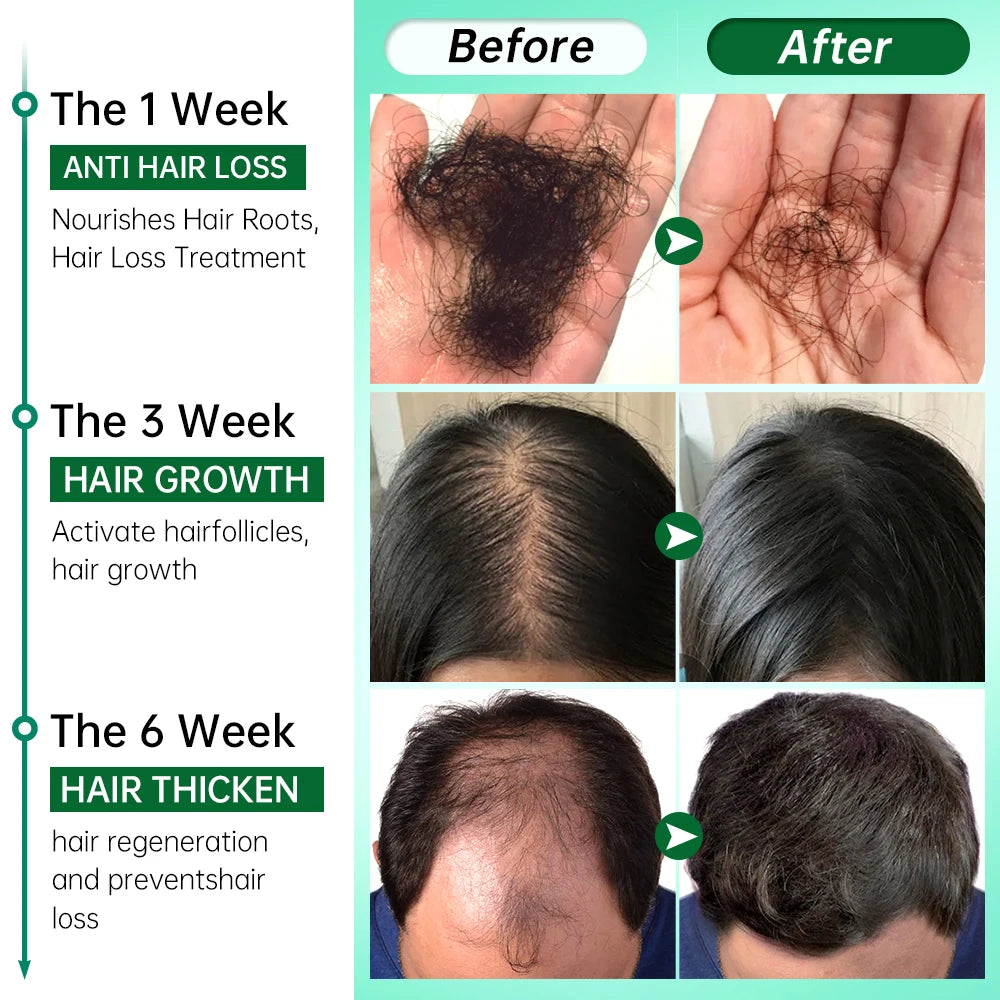 Rosemary Ginger Hair Growth Oil: Advanced Solution for Hair Loss & Scalp Care