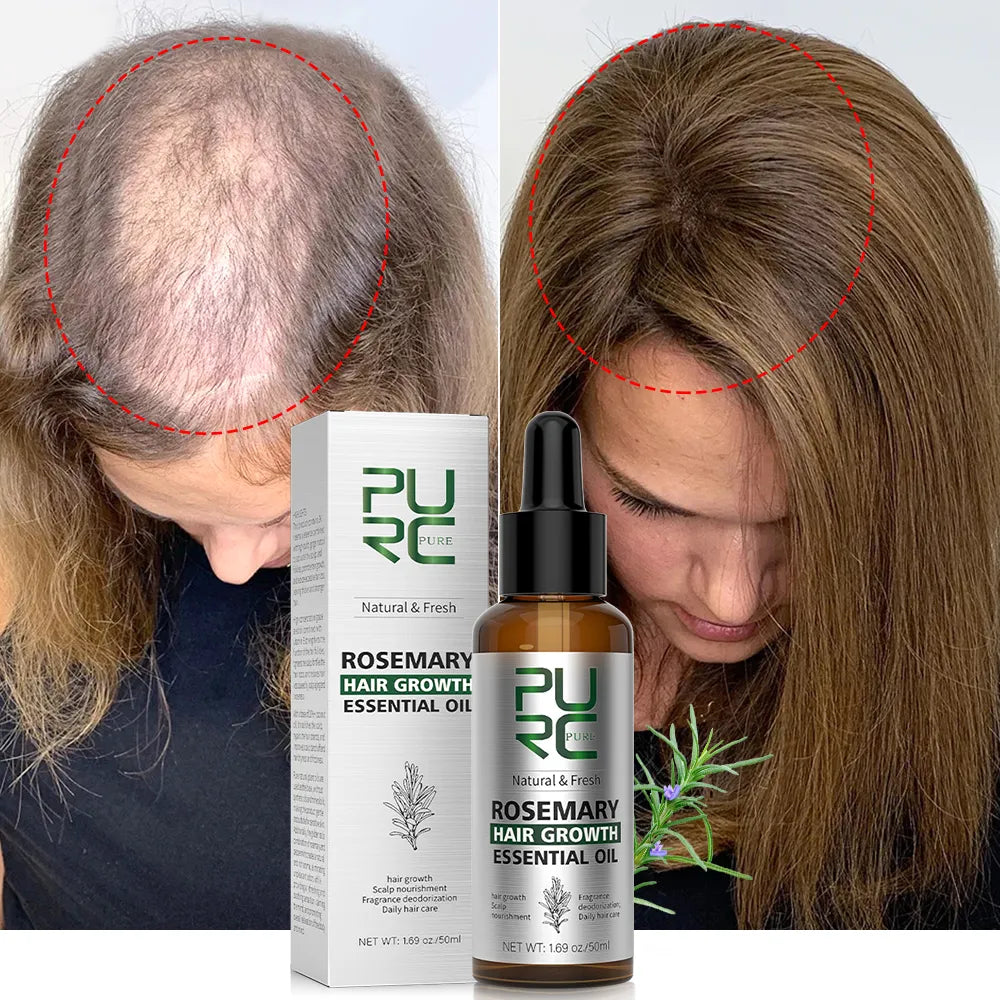 PURC Rosemary Oil Hair Growth for Men Women Fast Growing Products Essential Oils Ginger Anti Hair Loss Scalp Treatment Hair Care  beautylum.com   