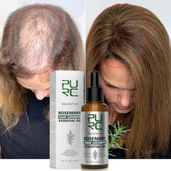 Rosemary Ginger Hair Growth Oil: Advanced Scalp Treatment for Hair Loss