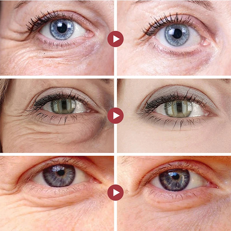 Anti Aging Lifting Firming Retinol Anti-Wrinkle Eye Cream Remove Eye Bags Dark Circles Whitening Moisturizing Brighten Skin Care  beautylum.com   