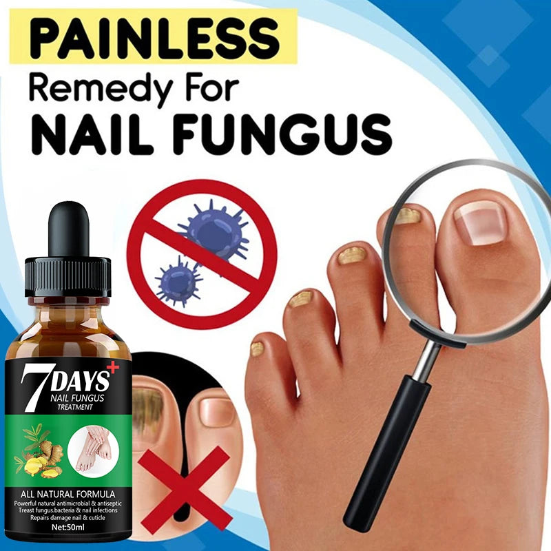 7DAYS Nail Fungus Treatment Essence Serum Care Hand and Foot Care Removal Repair Gel Anti-infective  beautylum.com   