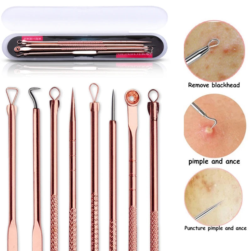 Pore Perfection Blackhead Removal Tool Set: Clear Skin Effortlessly