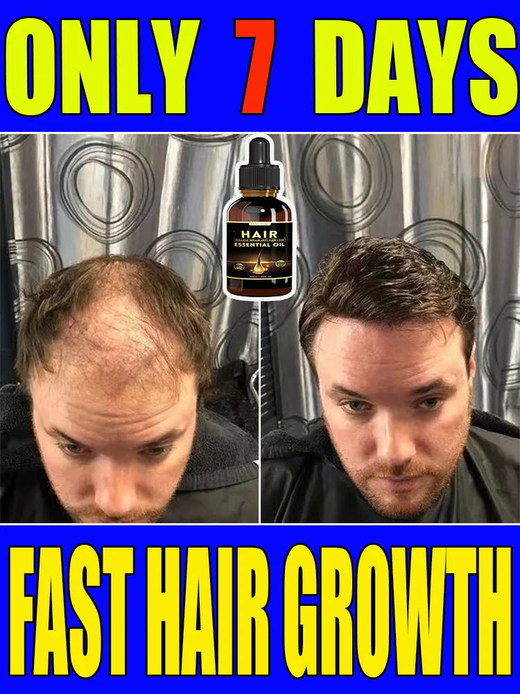 Best-selling Hair Growth Products, Anti-Hair Loss Hair Growth Serum for Men and Women, Fast Hair Growth Oil, 100% Natural  beautylum.com   