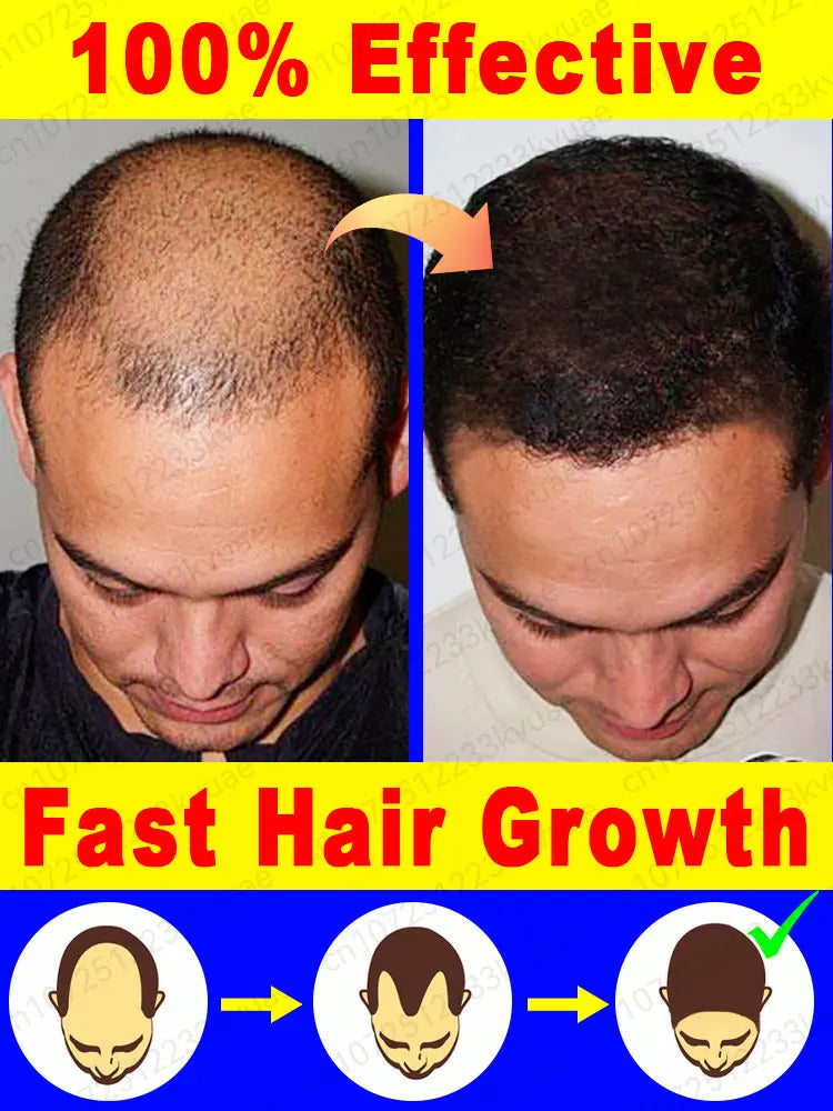 Hair Growth Repair Serum for Baldness & Alopecia - Effective Formula for Men Women