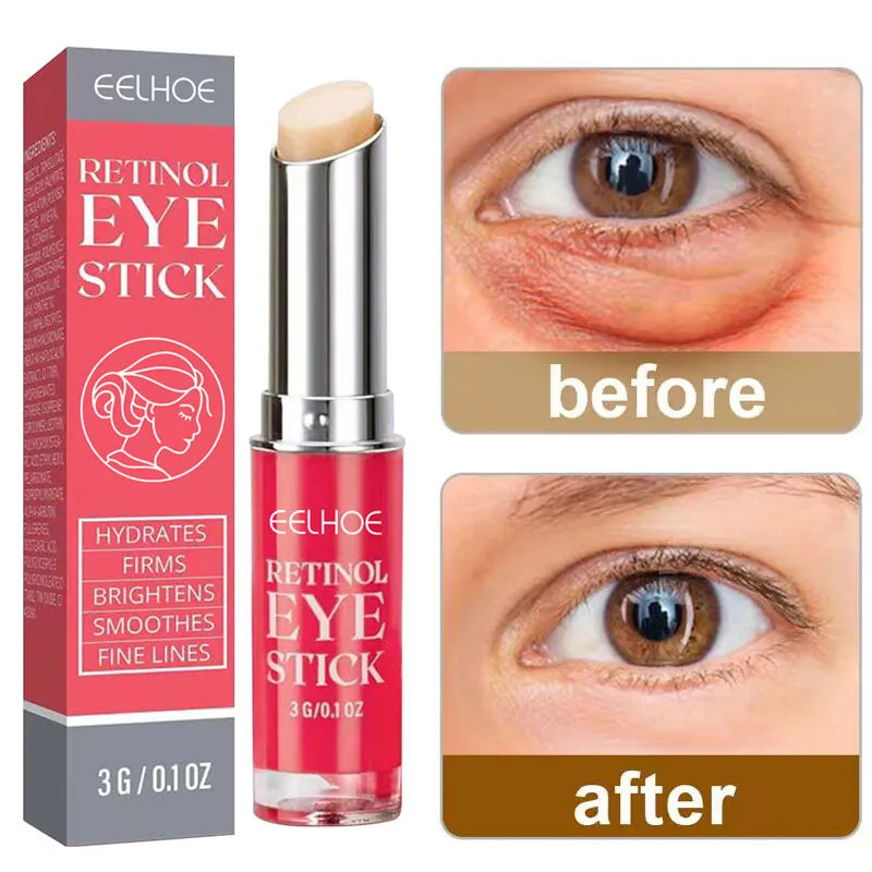 Retinol Anti-Wrinkle Eye Cream Remove Eye Bags Dark Circles Anti Aging Lifting Firming Whitening Moisturizing Brighten Skin Care  beautylum.com   