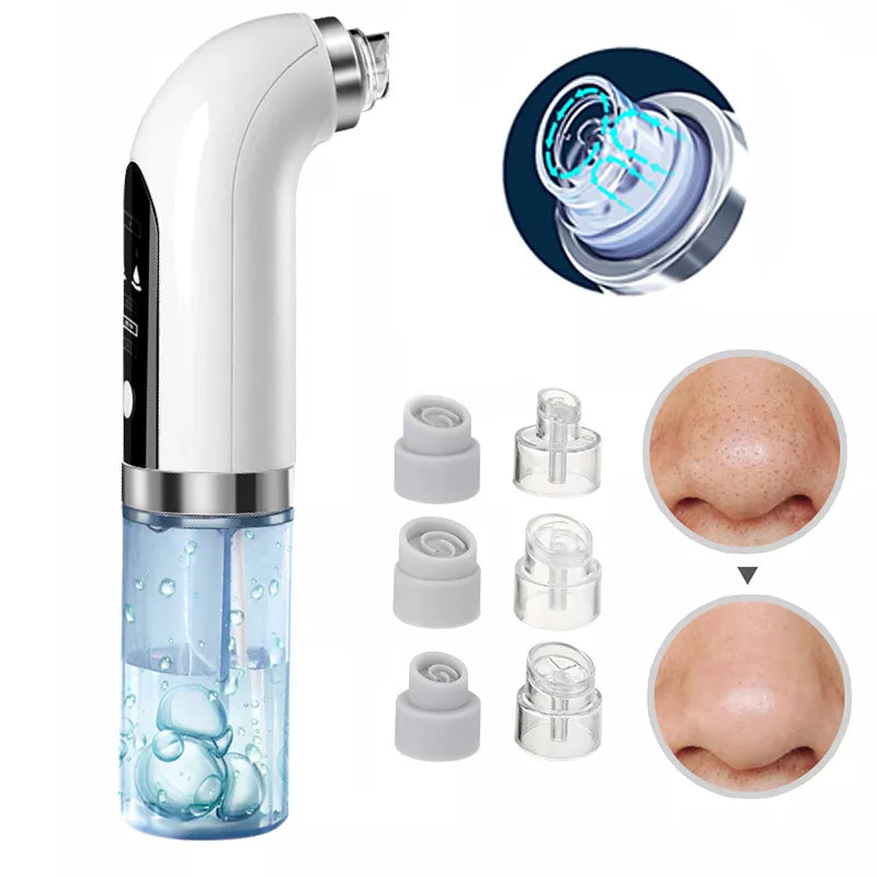 Blackhead Vacuum Pore Cleaner: Powerful Skin Purifier & Revitalizer