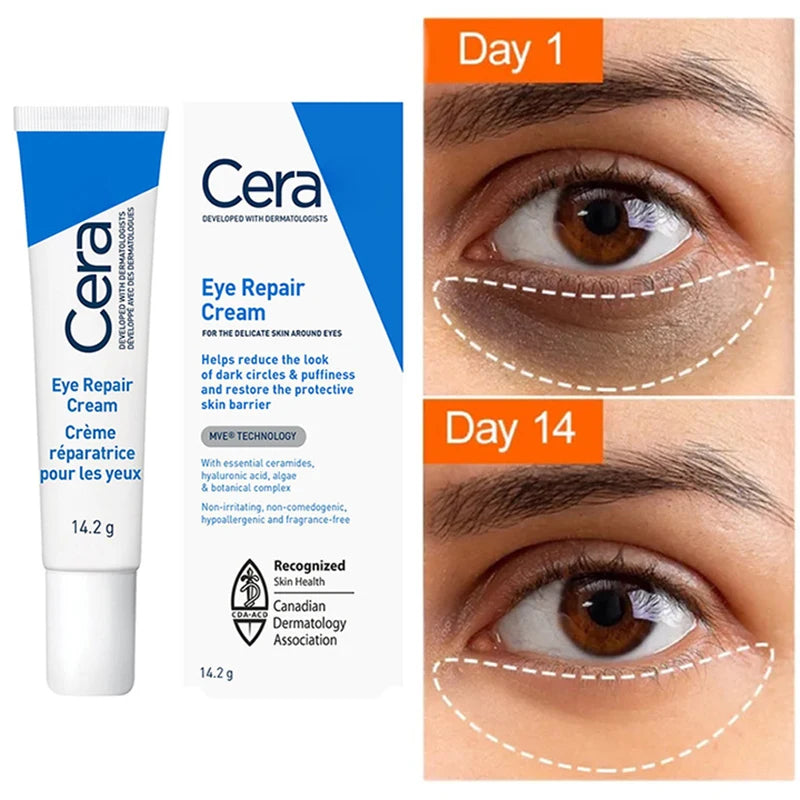 Ceramide Eye Cream Repair Skin Barrier For Dark Circles Under Eyes Puffiness Moisturizing Whitening Anti-Fine Lines Eye Care  beautylum.com Default Title  
