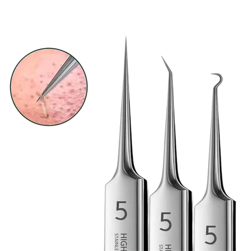 Precision Acne Extraction Kit: Clear Skin Tools for Radiant Results