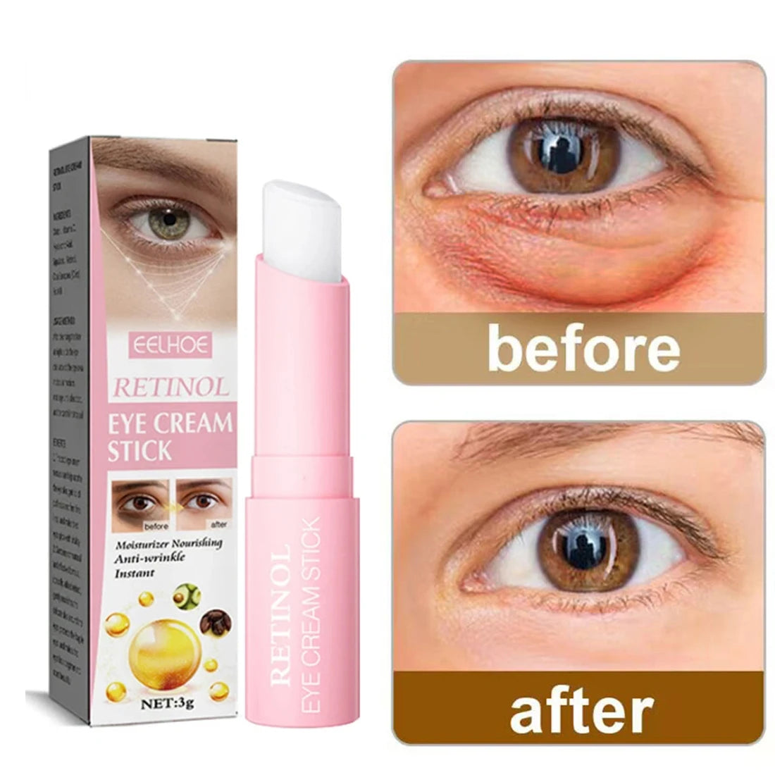 Youthful Skin Revitalizing Retinol Eye Cream: Combat Dryness & Dullness