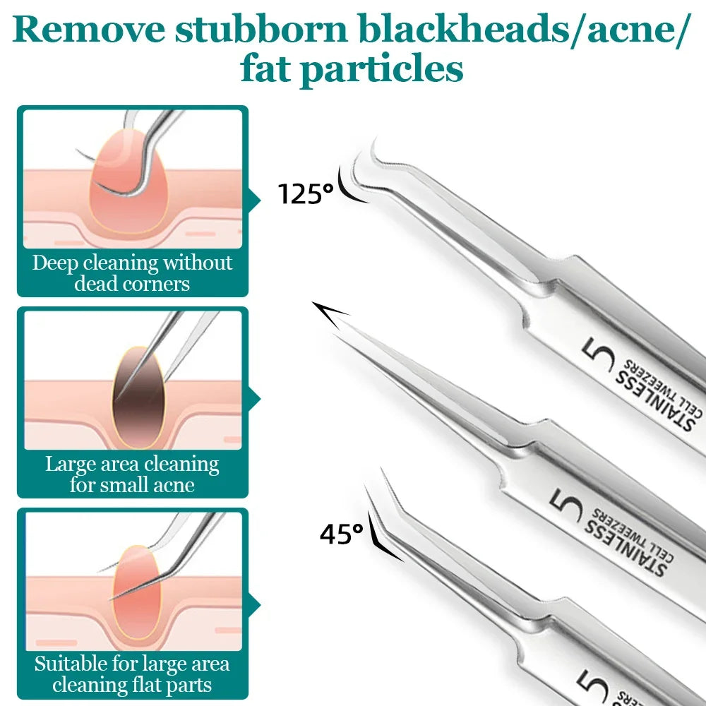 Blackhead and Pimple Extractor Kit: Effortless Clear Skin Solution