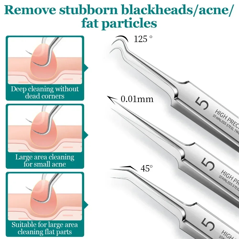 Clear Skin Blackhead Removal Set: Effortless Acne Extractor Kit