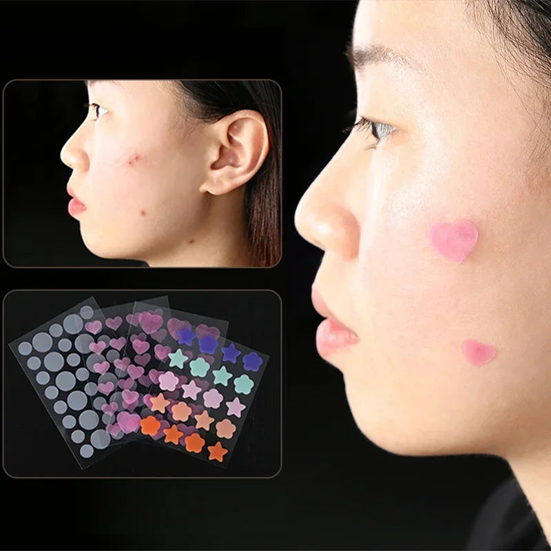Star Pimple Patch Acne Colorful Invisible Acne Removal Skin Care Stickers Y2K Originality Concealer Face Spot Beauty Makeup Tool  beautylum.com   