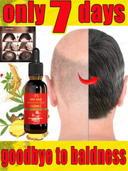 Hair Growth Oil: Rapidly Regrow Hair, Combat Baldness & Boost Confidence