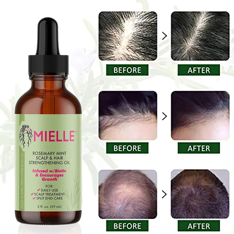 Rosemary Mint Hair Growth Oil: Nourish, Repair & Revitalize for Stronger, Vibrant Hair