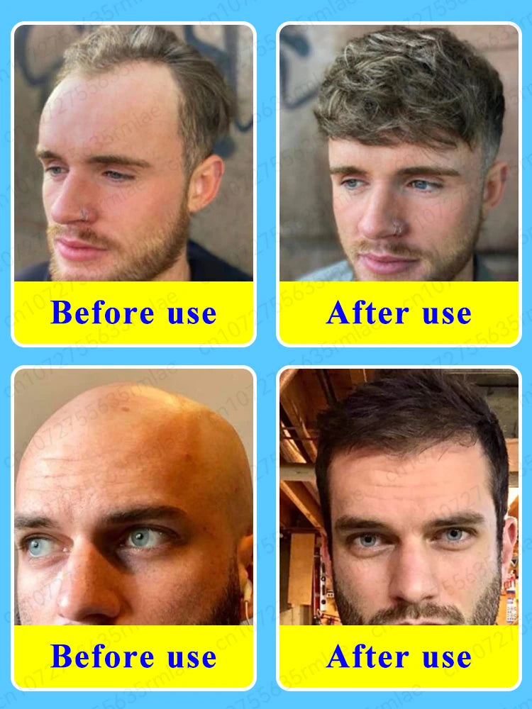 Rapid hair growth essential oil, repair baldness  beautylum.com   