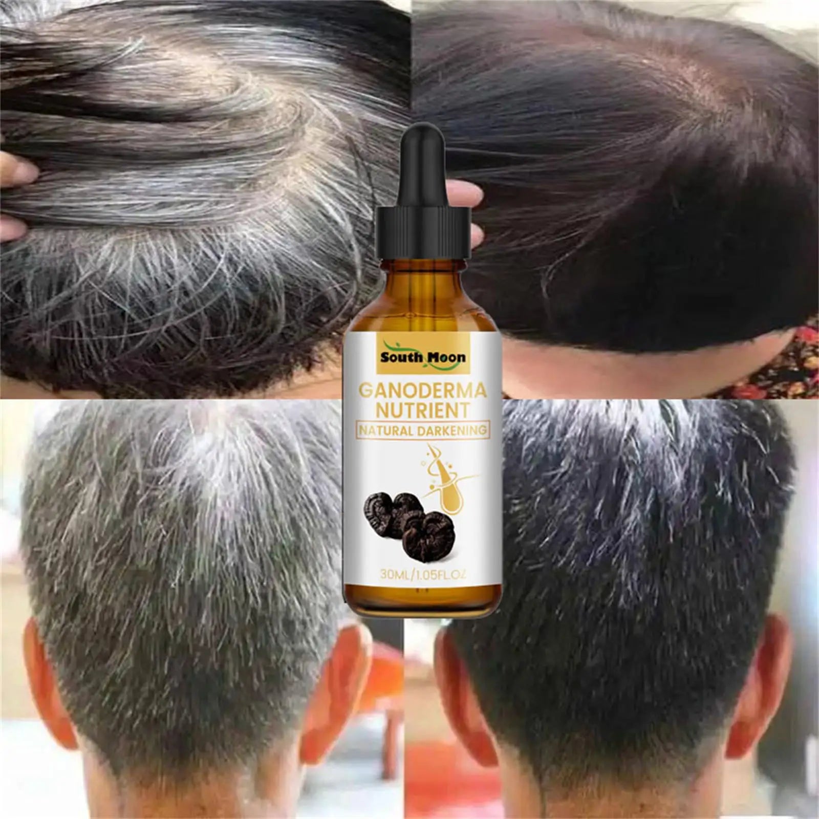 Gray to Black Hair Serum: Natural Color Repair & Nourishment - Anti Hair Loss Treatment