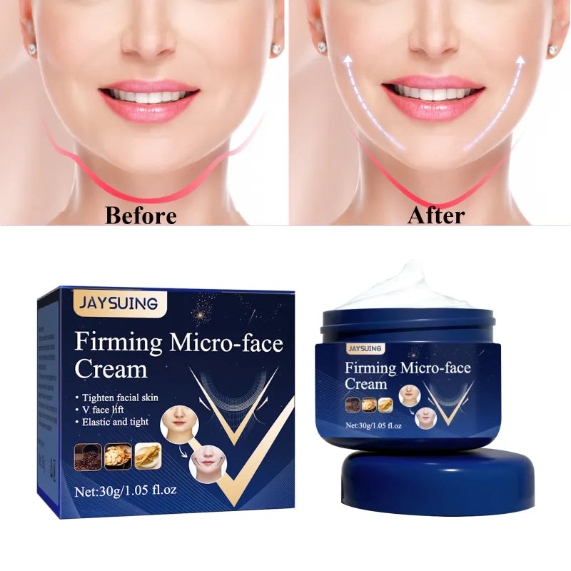 V-Shape Slimming Cream Removal Double Chin Firming Face-lift Slimming  Masseter Muscle Face Fat Burning Anti-aging Products  beautylum.com   