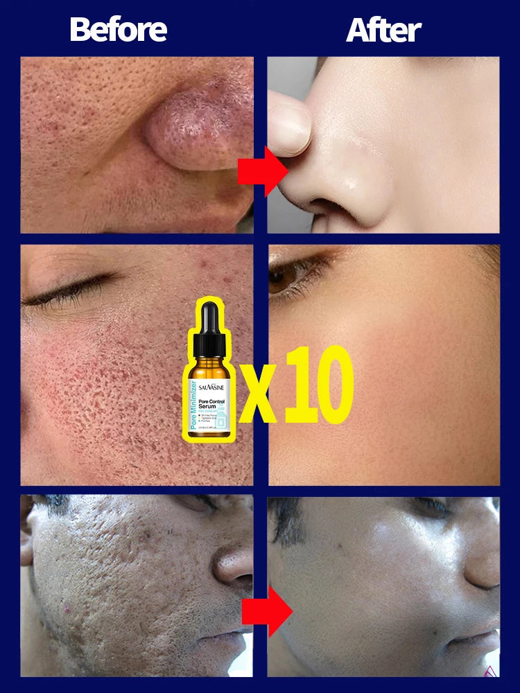 Pore Shrinking Serum Face Removing Large Pores Tightening Repairing Facial Pore Minimizing Essence Skin Care Beauty  beautylum.com   