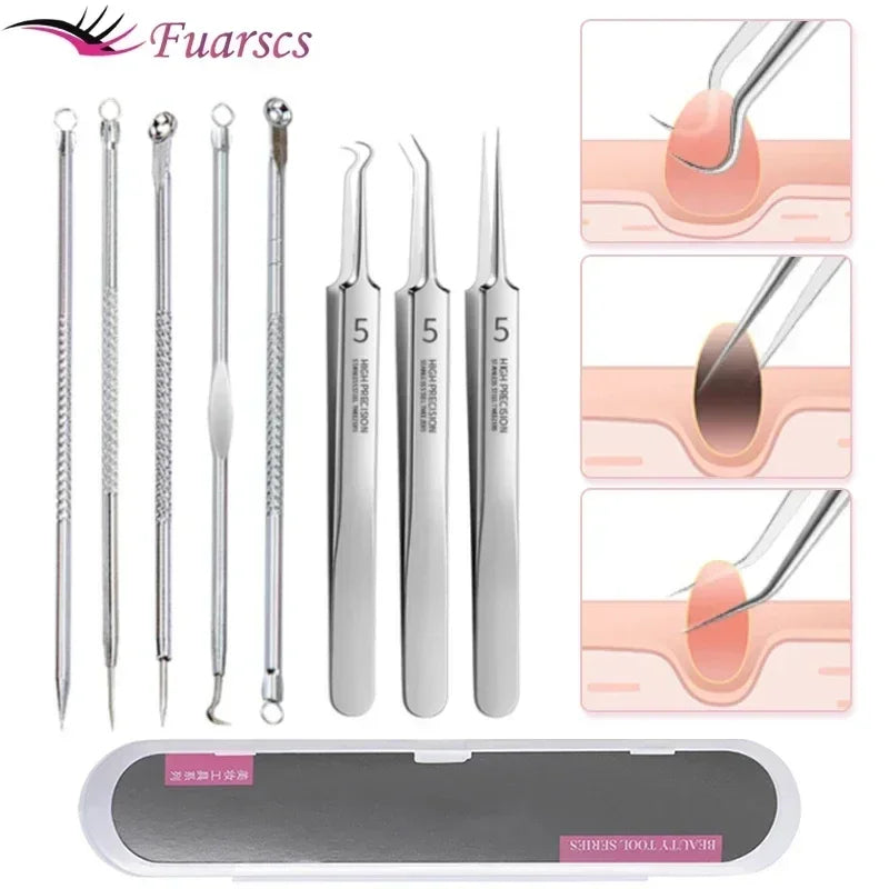 Clear Skin Blackhead Removal Set: Effortless Acne Extractor Kit