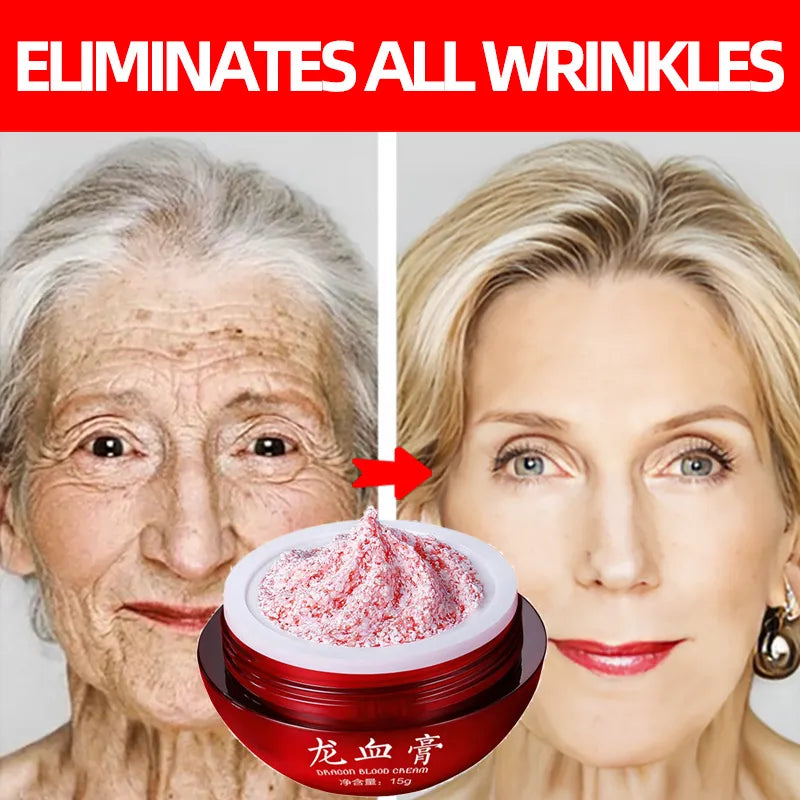 Youthful Glow Retinol Placenta Face Cream: Combat Wrinkles & Aging
