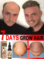 Hair Growth Oil: Rapid Repair for Baldness & Hair Loss