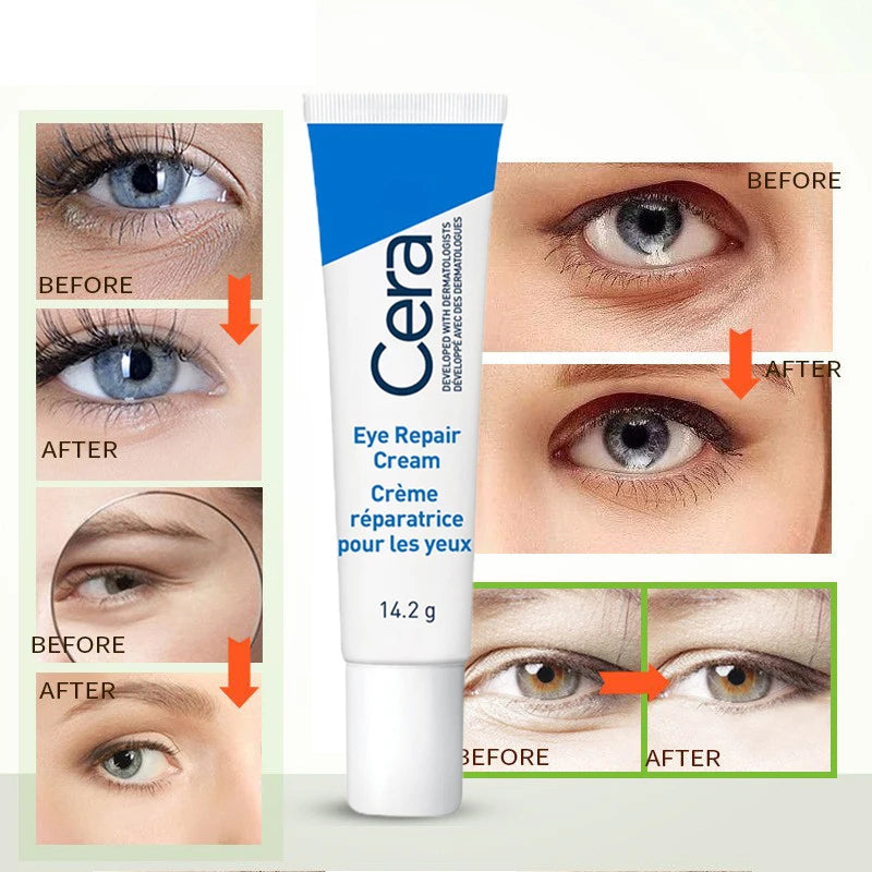 Ceramide Eye Cream Repair Skin Barrier For Dark Circles Under Eyes Puffiness Moisturizing Whitening Anti-Fine Lines Eye Care  beautylum.com   