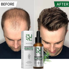 Rosemary Oil Hair Growth Elixir - Transform Your Haircare Journey