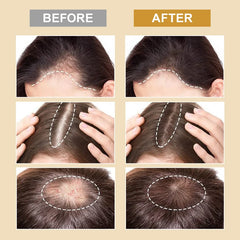 Biotin & Collagen Hair Growth Spray: Rapid Growth & Loss Treatment
