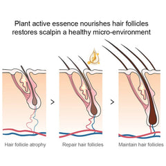 Hair Regrowth Elixir: Herbal Onion Black Seed Hair Spray
