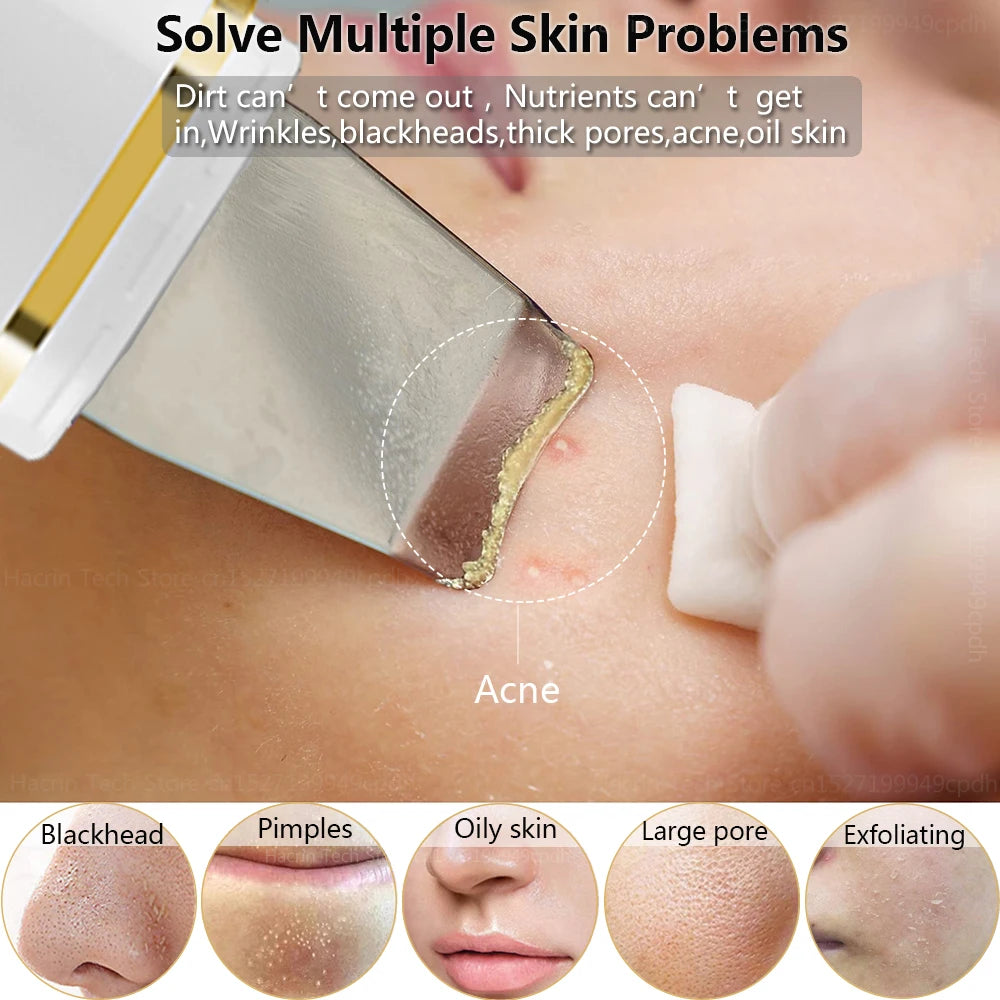 Ultrasonic Skin Scrubber Remover Blackhead Ultrasonic Peeling Facial Scrubber Shovel Deep Cleaning Face Lifting Remove Pore Acne  beautylum.com   