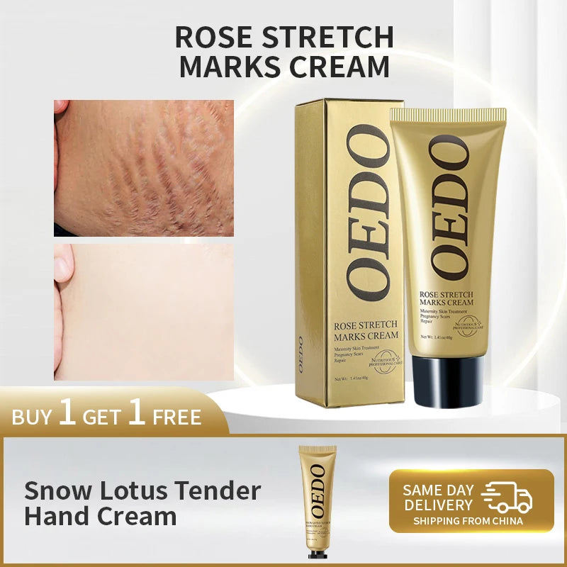 Rose Removes Stretch Mark Cream To Remove Postpartum Obesity Pregnant Women Repair Anti-Aging Anti-Winkles Firming Body Cream  beautylum.com   